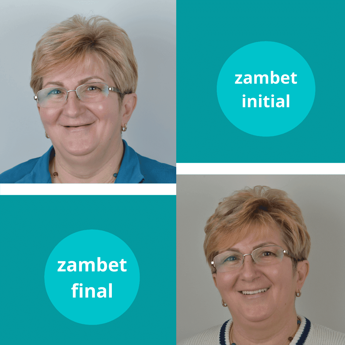 Refacere zâmbet