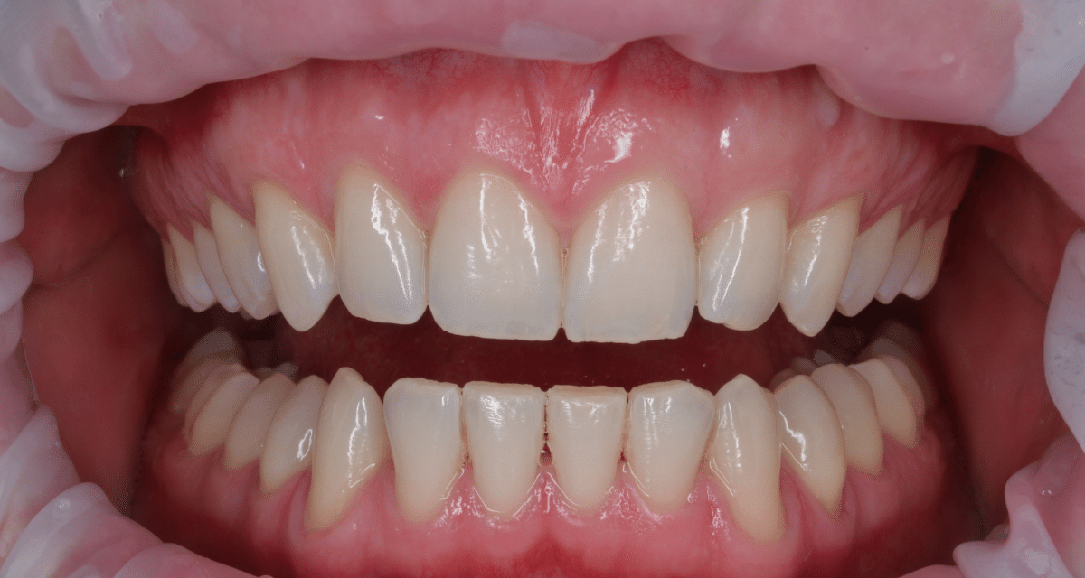 https://www.dentalcreation.ro/wp-content/uploads/2022/03/albire-dentara-dental-creation-clinic-tareq-hajaj-timisoara-1200x640.png