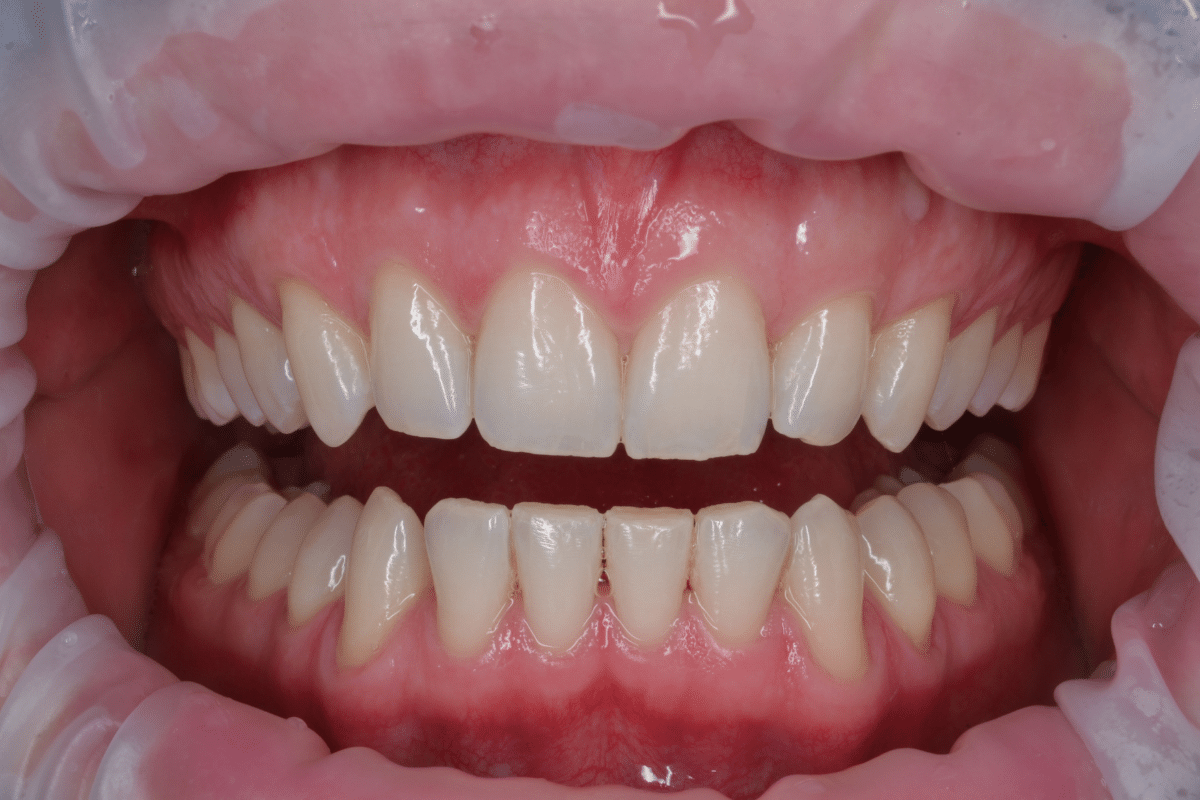 https://www.dentalcreation.ro/wp-content/uploads/2022/03/albire-dentara-dental-creation-clinic-tareq-hajaj-timisoara.png