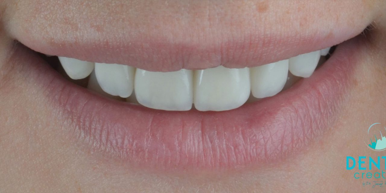 https://www.dentalcreation.ro/wp-content/uploads/2022/04/estetica-dentara-clinica-dental-creation-Tareq-Hajaj-Timisoara-1-1280x640.jpg